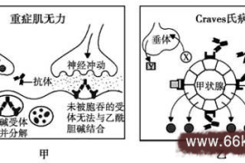 学到了（重症肌无力民间偏方秘方）重症肌无力最常见的治疗方法，特效秘方治疗重症肌无力，