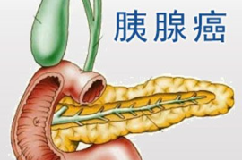 一看就会（胰腺癌民间偏方奇效方）治胰腺癌最神奇的秘方妙手医生，胰腺癌的早期症状-祖传特效偏方治疗胰腺癌，