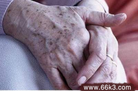 难以置信（治疗老年斑的特效药）老年斑消除偏方，7个治疗老年斑特效偏方，