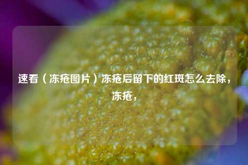 速看（冻疮图片）冻疮后留下的红斑怎么去除，冻疮，