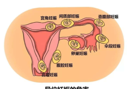 难以置信（输卵管妊娠最合适的治疗原则）输卵管妊娠的处理原则有哪些?，输卵管妊娠怎么治疗-祖传特效输卵管妊娠偏方，