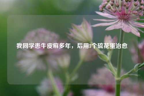 我同学患牛皮癣多年，后用3个硫花蛋治愈